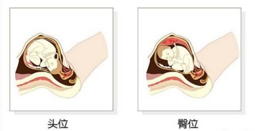 三代试管婴儿虽然技术先进，但是也要考虑费用成本