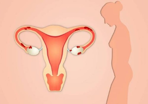 汕尾助孕机构：孕期乳头流出红色液体怎么办,健康护理要点指南